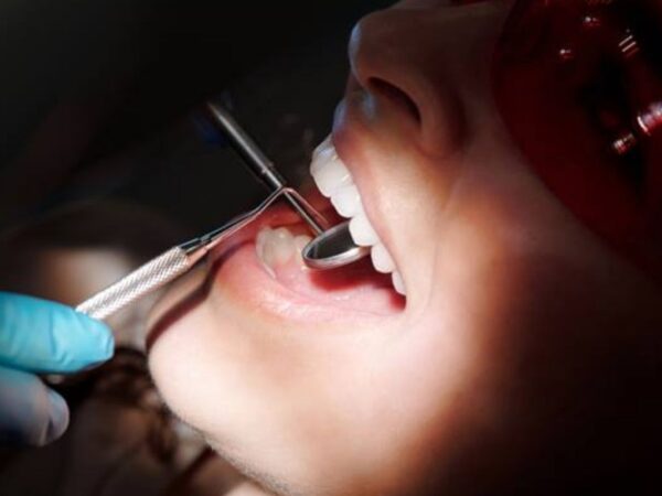 Fix patentos fogsor 4 implantátummal, konzultációval és panoráma röntgennel